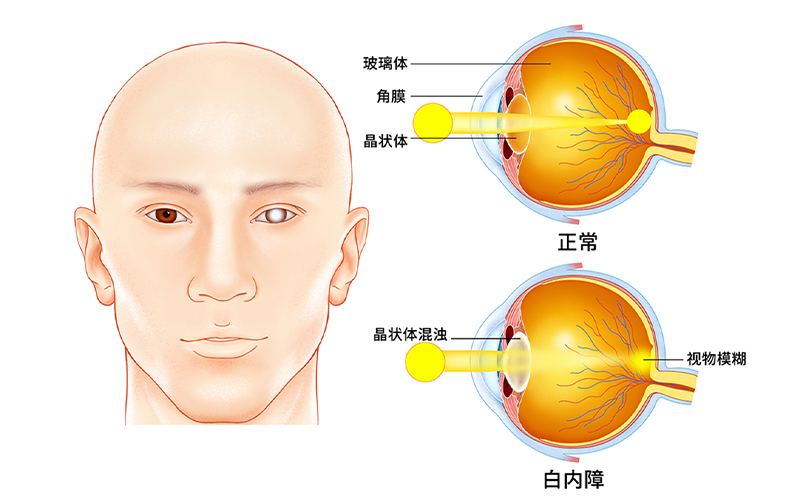 ��ҽ��ʱ�����ס��󿧡�����۵ס�ɱ�֡��� �ջ� �����з硱���ߣ�ƽ��ӵ�������ӽ�